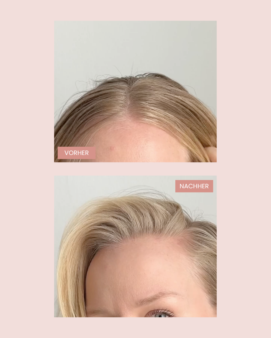 Vorher Nachher Bild vom Trockenshampoo Spray von feschi