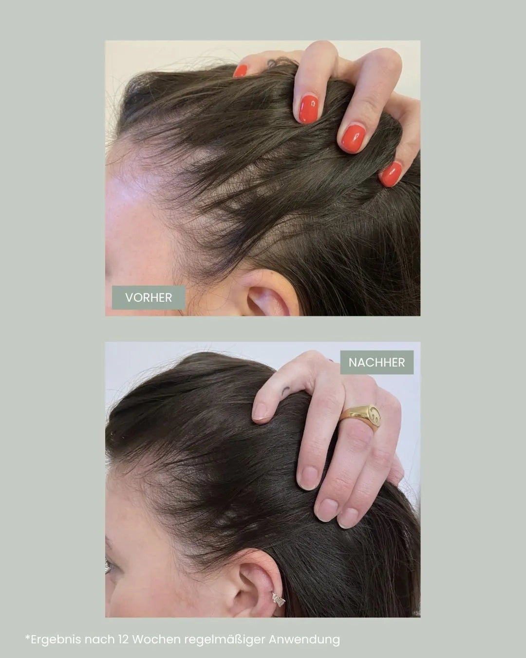 Vorher Nachher Haarwachstumsprodukte von feschi