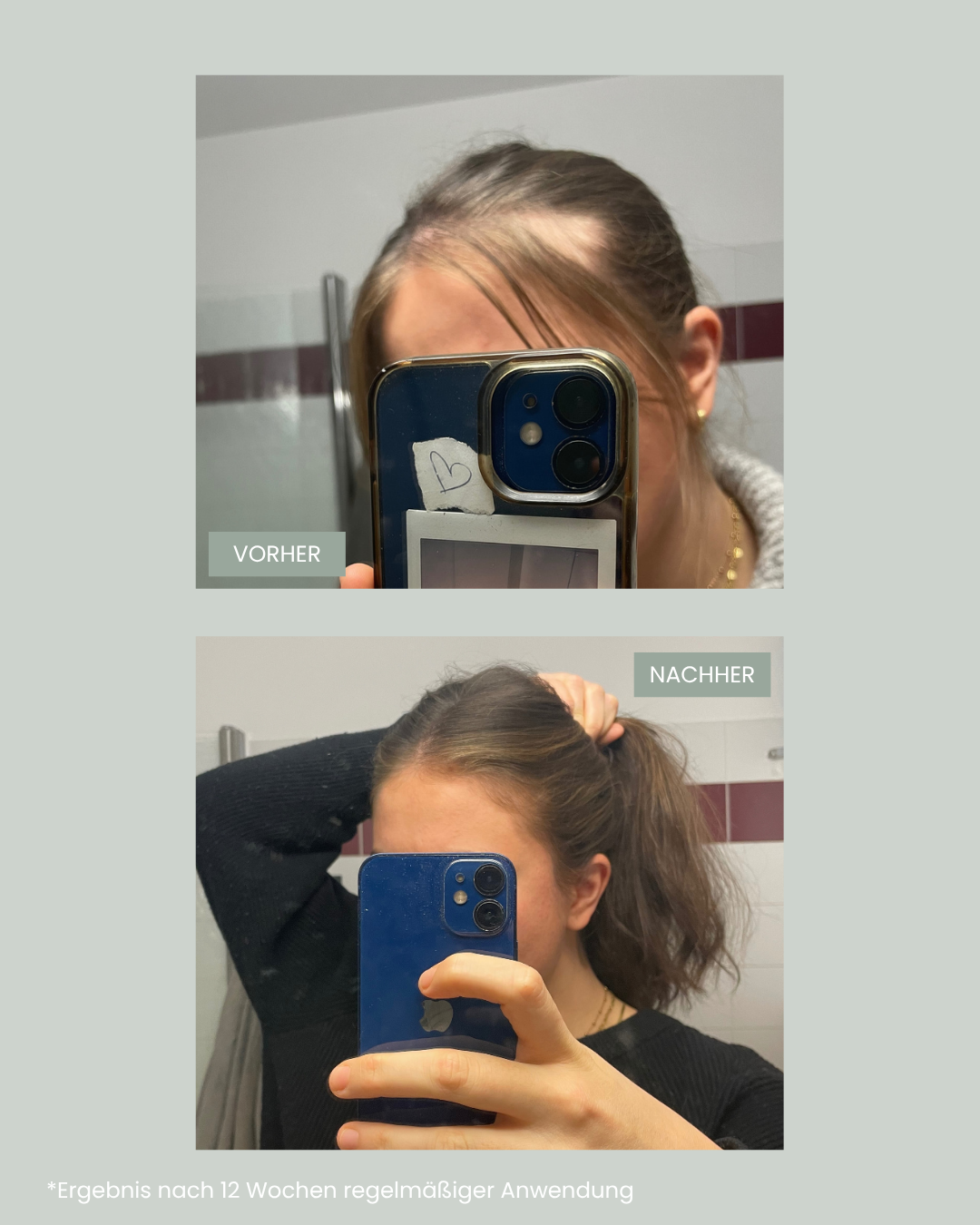 Eine Vorher Nachher Abbildung von einer Frau, die 12 Wochen lang die grow strong Produkte von feschi mit tollem Ergebnis verwendet hat