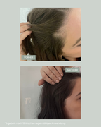 Ein Vorher Nachher Bild von Haaren nach der Anwendung der feschi Haarwachstums-Produkte