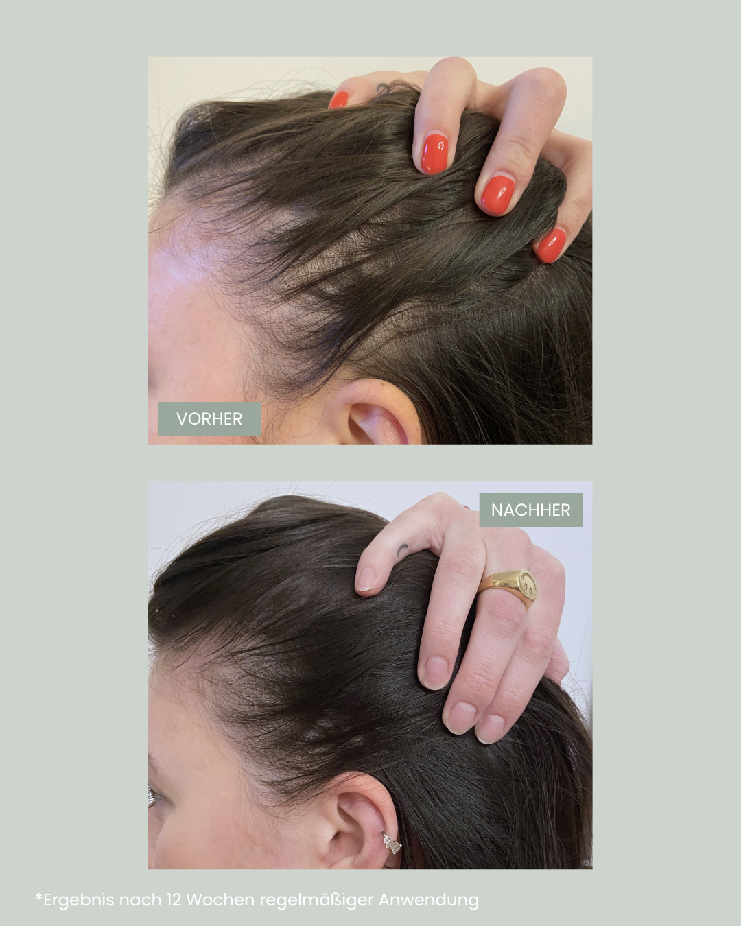 Vorher Nachher Haarwachstumsprodukte von feschi