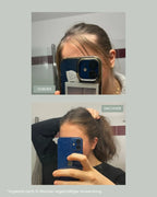 Vorher-Nachher-Vergleich bei Haarausfall: sichtbarer Haarwachstum nach 12 Wochen regelmäßiger Anwendung