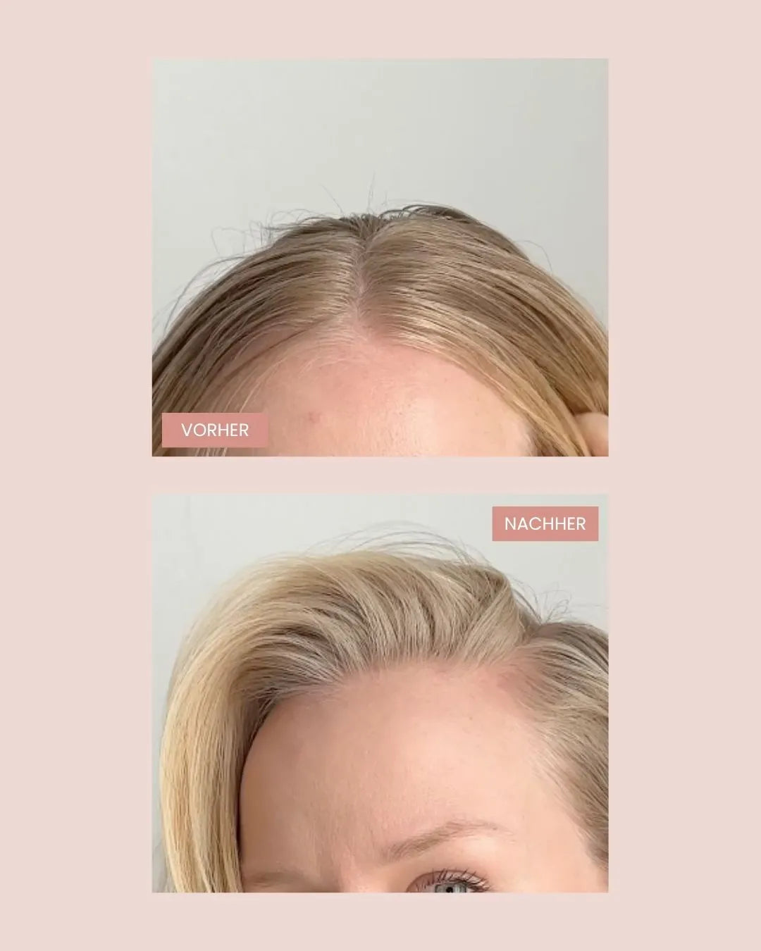 Vorher-Nachher Vergleich zeigt fettige und aufgefrischte Kopfhaut nach Anwendung von Trockenshampoo Schaum