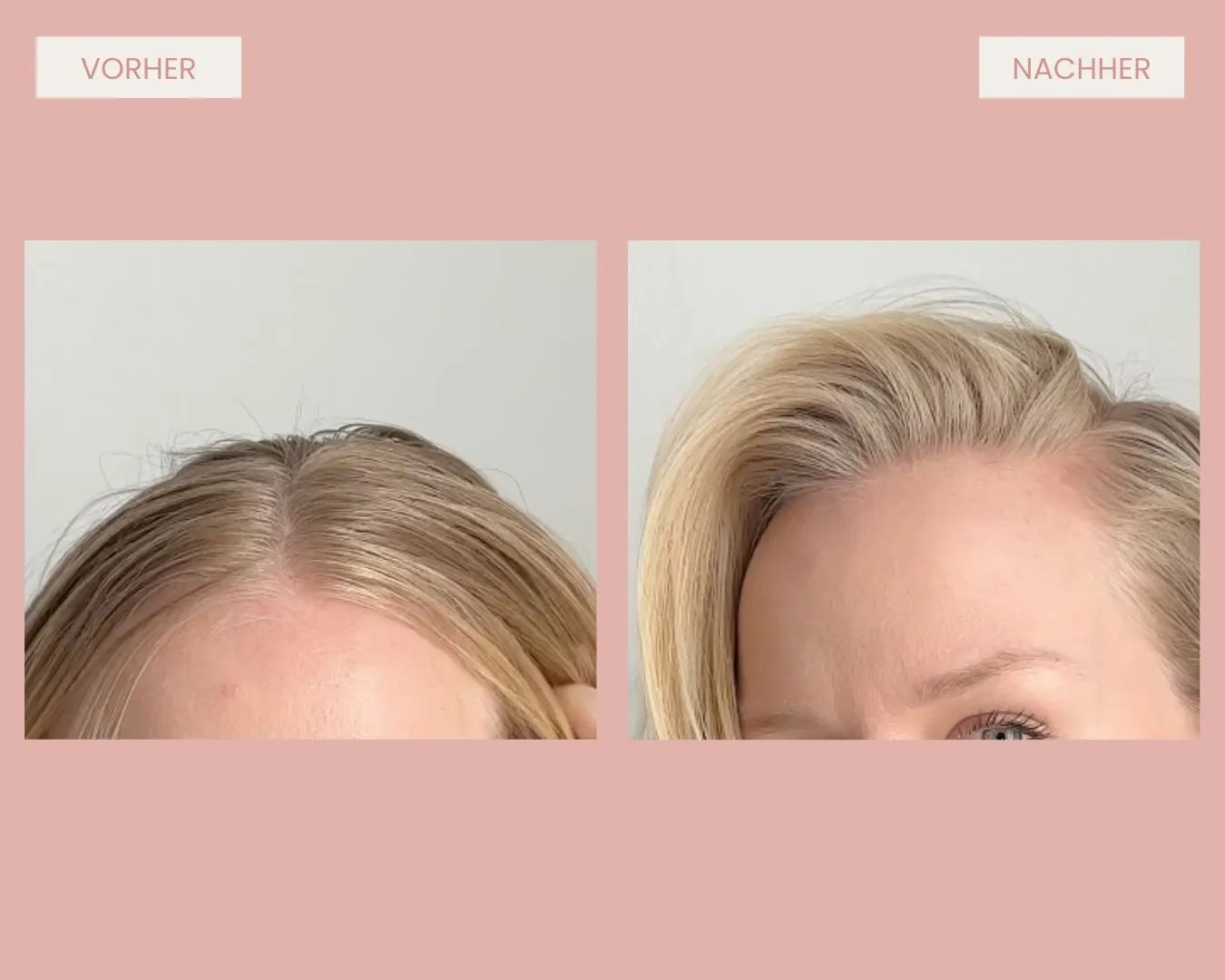 vorher nachher vom ansatz einer frau mit anwendung trockenshampoo spray feschi