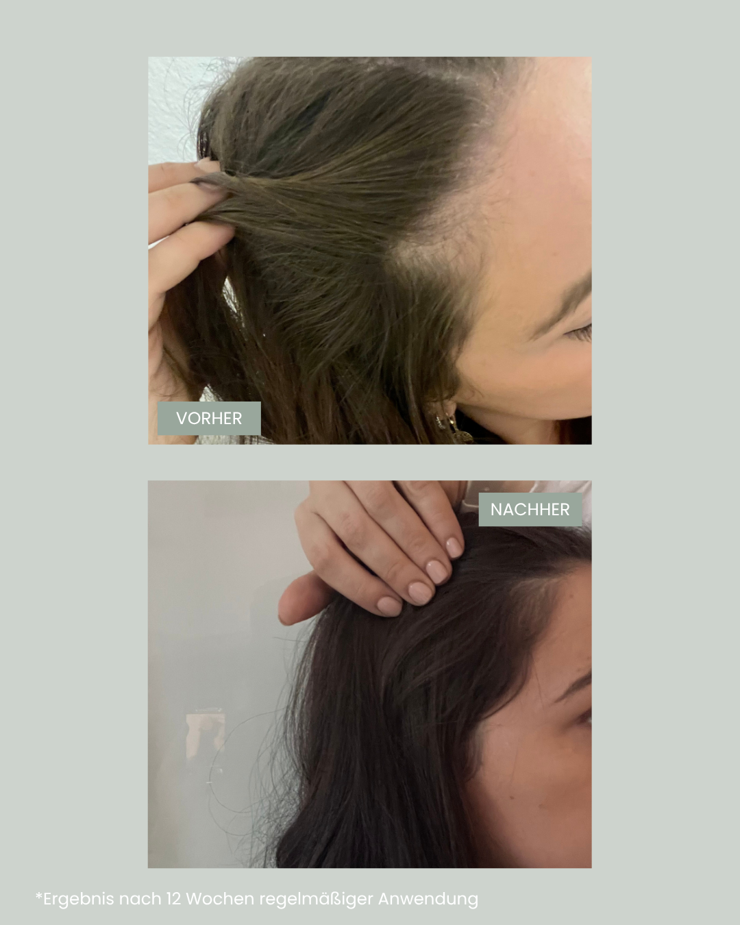 vorher nachher nach der Einnahme vom feschi Hair Growth Supplement. Mehr Haarwachstum in nur 12 Wochen.