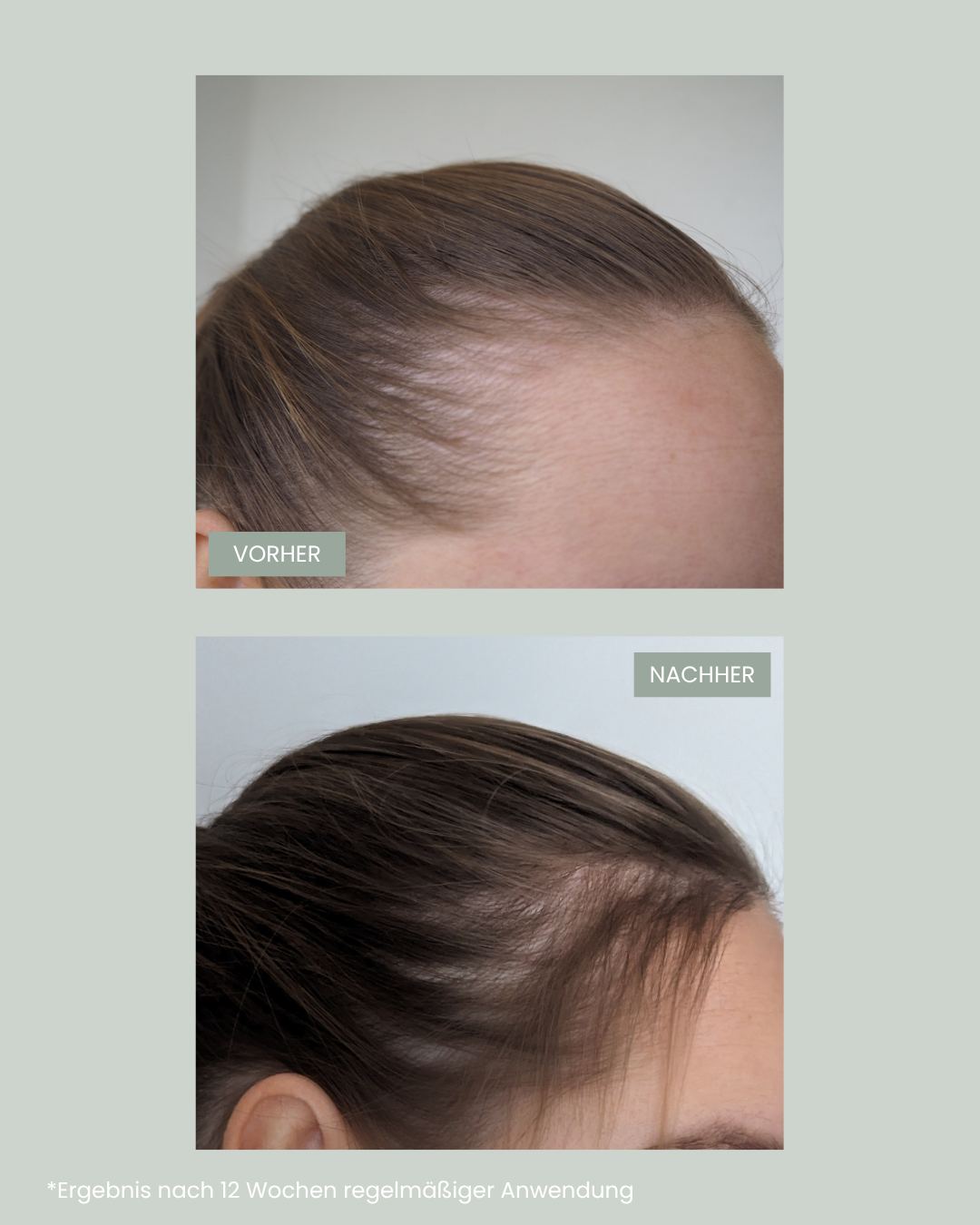 vorher nachher Vergleich nach der Einnahme von feschi grow strong Supplements. Mehr Haarwachstum garantiert.